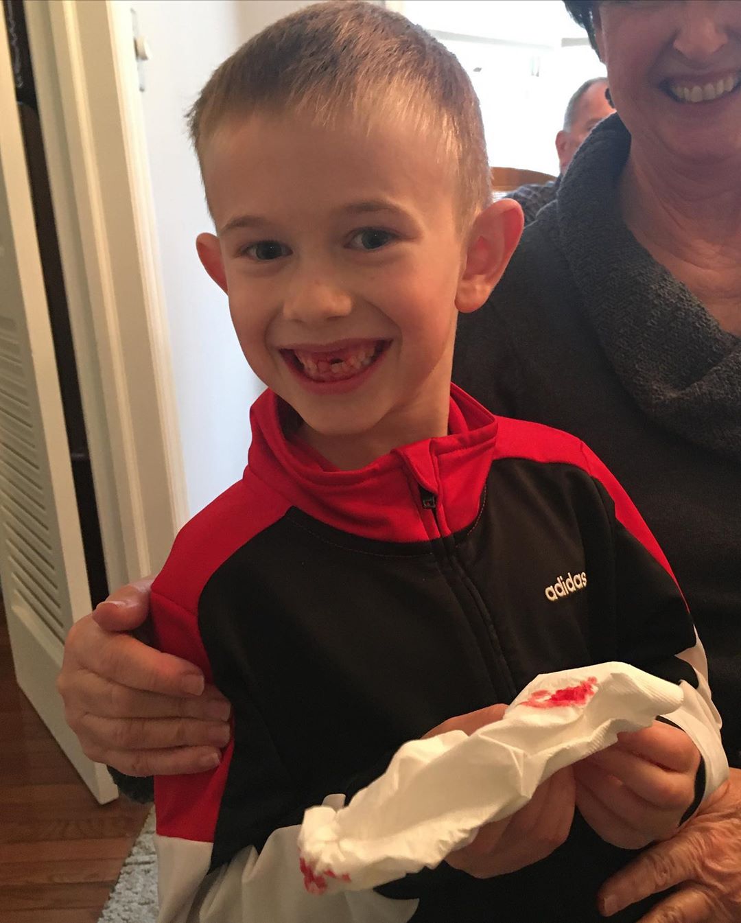 Am I missing a tooth? 🦷